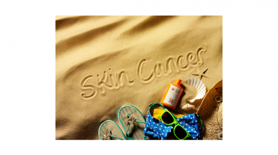 "skin cancer" written in the sand on the beach surrounded by sunblock lotion, sunglasses, flip flops, hat, bathing suit, and sea shells