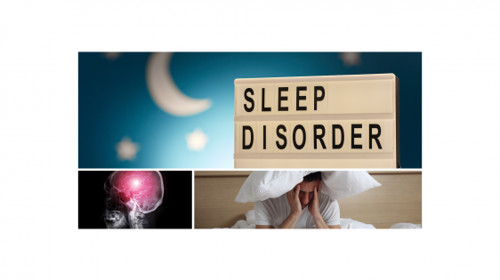 top: sign saying 'sleep disorder', bottom left: MRI of an angiogram, bottom right: man in bed with a pillow over his head struggling with insomnia